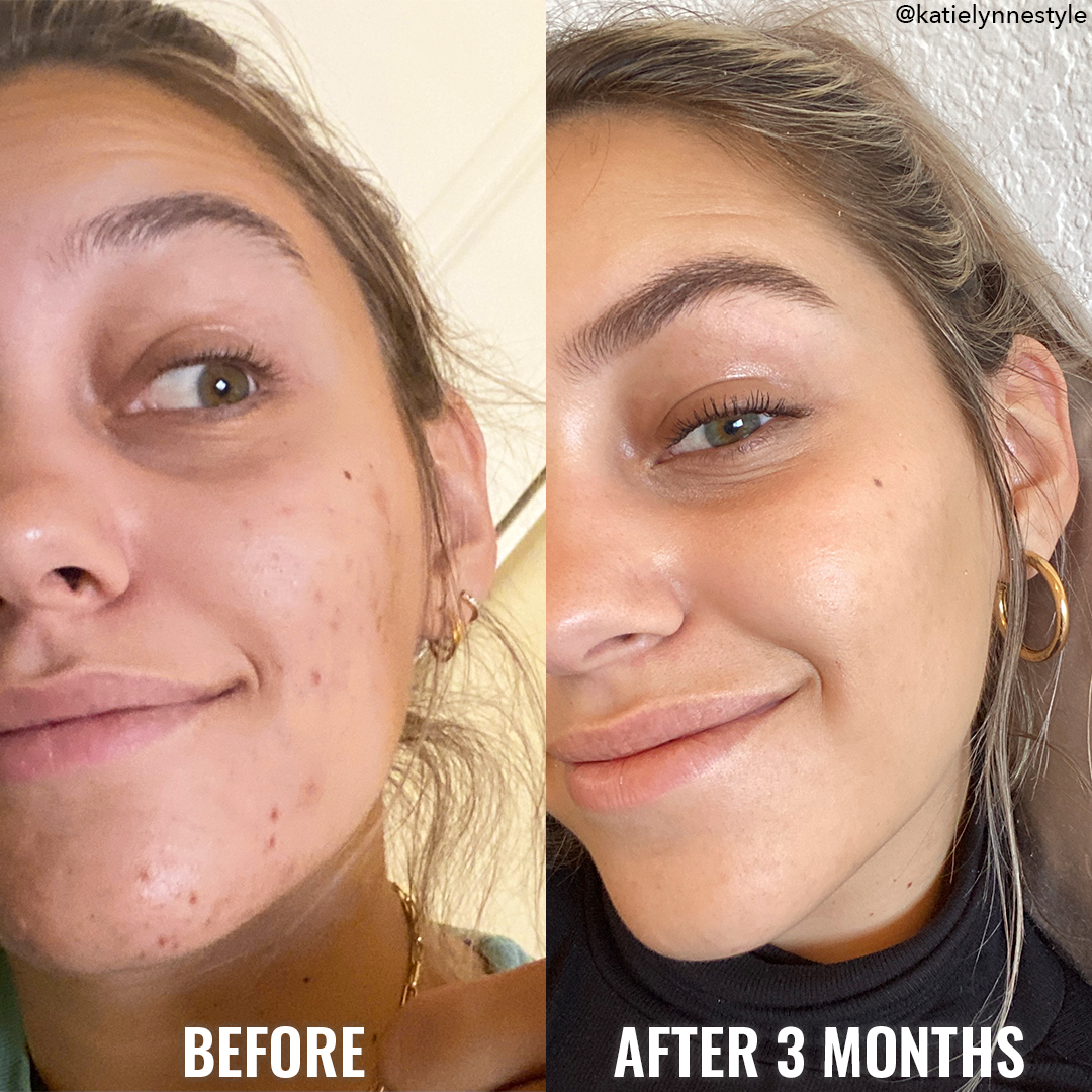 Tónico de Niacinamide Good Molecules 120ml