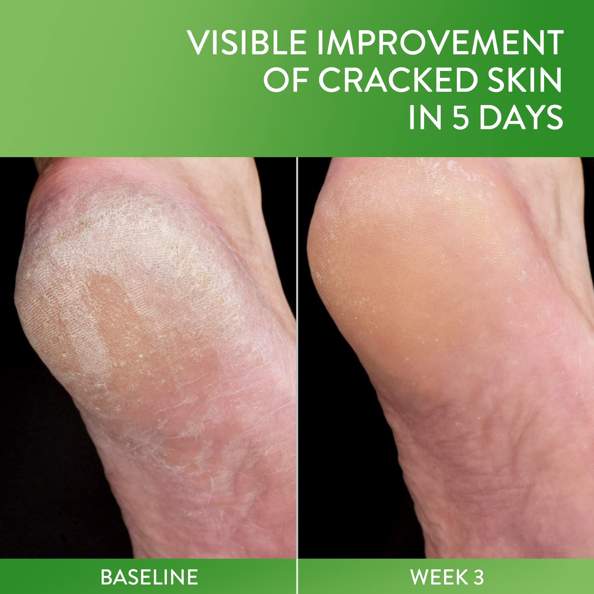 Crema Reparadora para Pieles Muy Secas y Quebradas