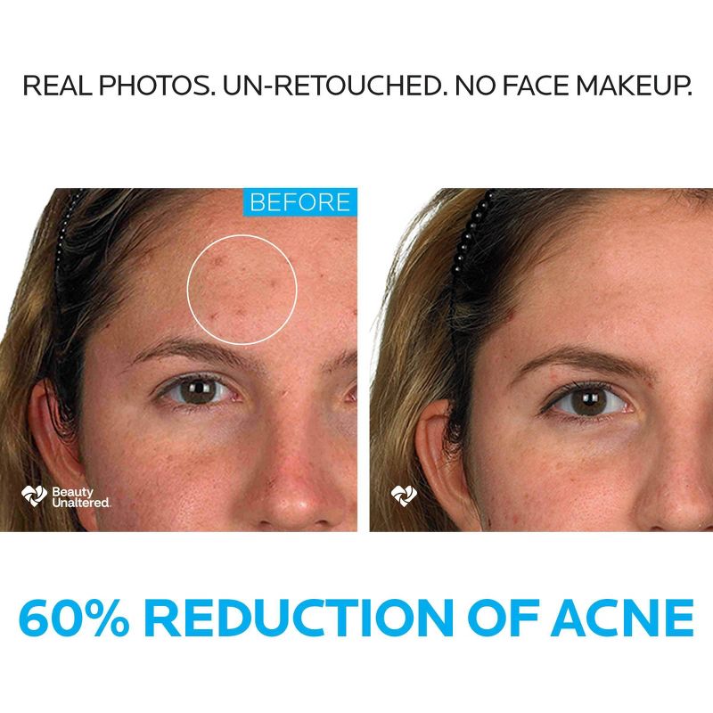 Step Acne Routine Effaclar La Roche-Posay