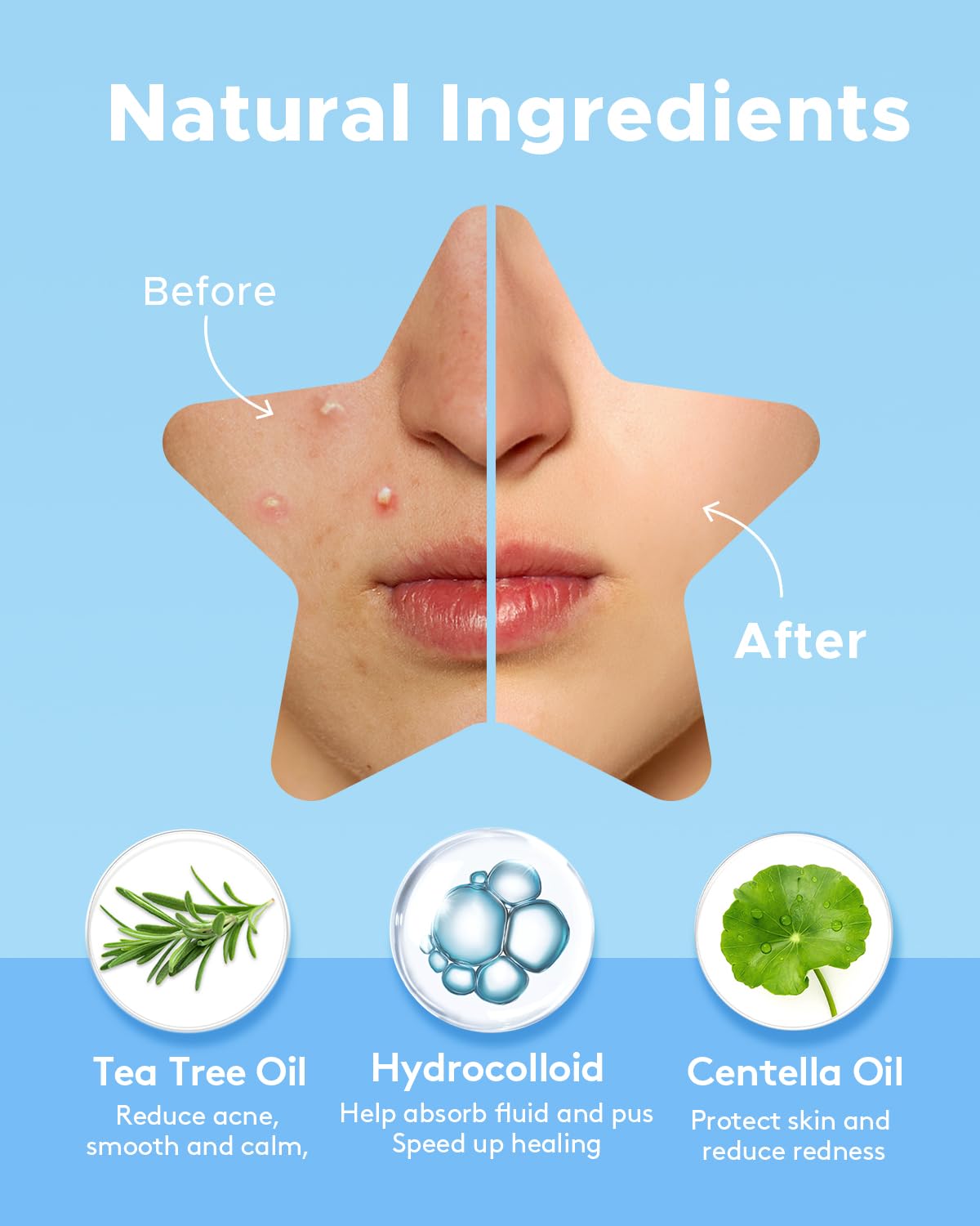 Parches LitBear 168 Estrellas